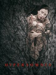 Гиперсомния